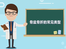 【醫(yī)療科普】骨盆骨折的常見類型有哪幾種？
